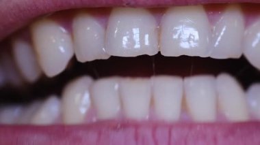 Genç bir adamın sağlıklı dişlerini göstererek ağzını açıp kapamasının detaylı makro görüntüsü.