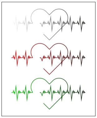 Graphic illustration of cardiogram or cardiograph. Electrocardiogram in black and white, red and green. Heart rate. EKG or ECG test. Heartbeat graph. Vector. Isolated. clipart