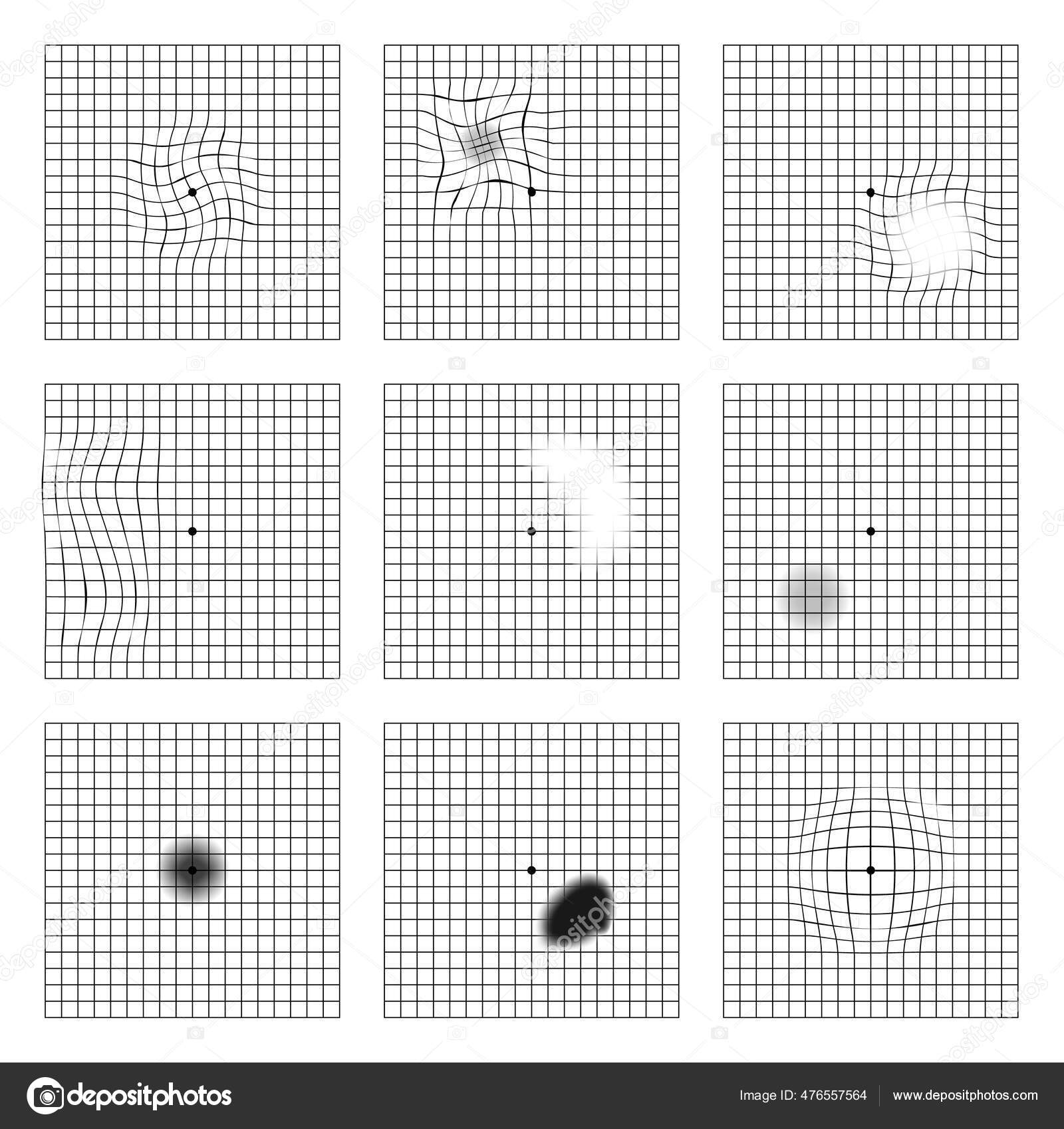 Amsler Eye Test Grid Vector Printable Chart Retina Examination Grid Amsler Eye Test Grid Vector Printable Chart Retina Examination Grid