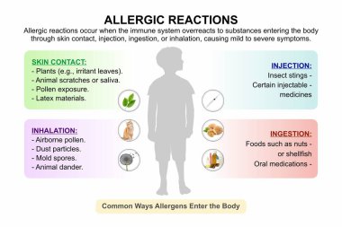 Çocuklarda alerjik reaksiyonlar, tıbbi hafıza kartı çizimleri