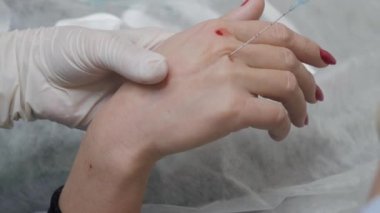 Kozmetik uzmanı hastanın avucuna bir iğne yerleştirir..