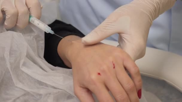 Kosmetologen för in en injektion i patientens handflata. — Stockvideo