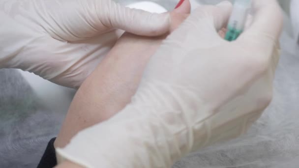 Kosmetolog wstrzykuje lek pacjentowi w dłoń.. — Wideo stockowe