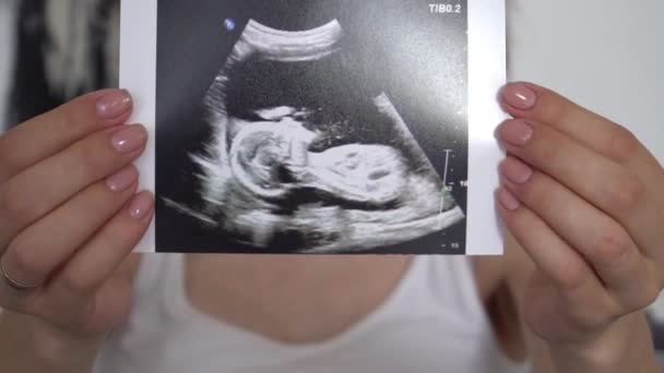 孕妇在床上抱着超声波扫描婴儿全景的剪影 — 图库视频影像