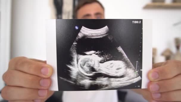 Großaufnahme Eines Mannes Mit Einem Scan Von Baby Ihren Händen — Stockvideo