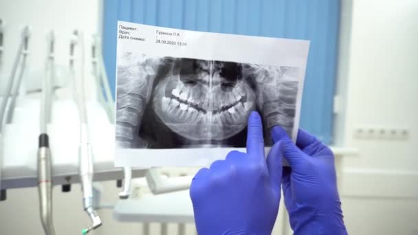 Zbliżenie Dentystkę Wskazującą Zdjęcie Rentgenowskie Pacjenta Gabinecie Stomatologicznym — Wideo stockowe