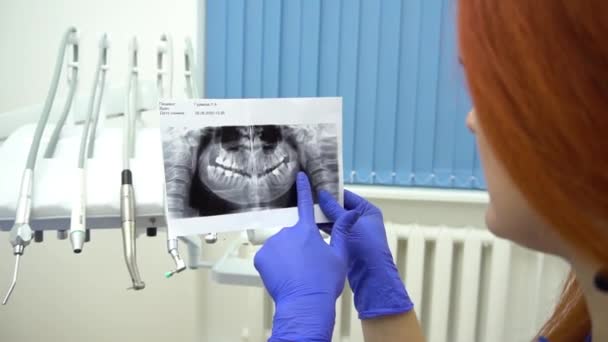 Närbild Kvinnlig Tandläkare Pekar Patientens Röntgenbild Tandläkarmottagningen — Stockvideo