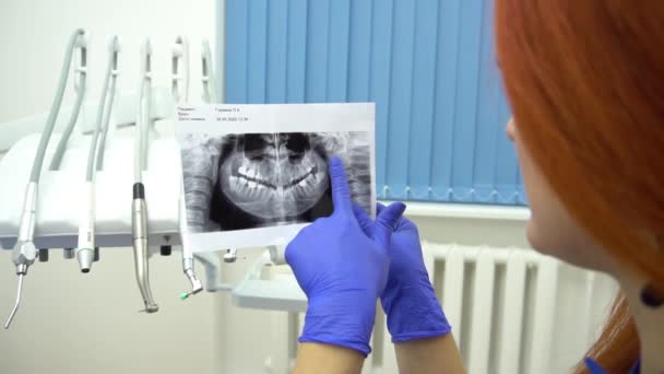 Slow Motion Dentystka Trzymająca Prześwietlenie Zębów — Wideo stockowe