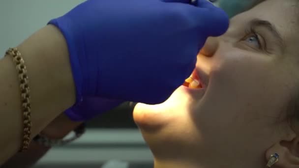 Primer Plano Los Dientes Hermosa Niña Caucásica Paciente Abierta Boca — Vídeo de stock