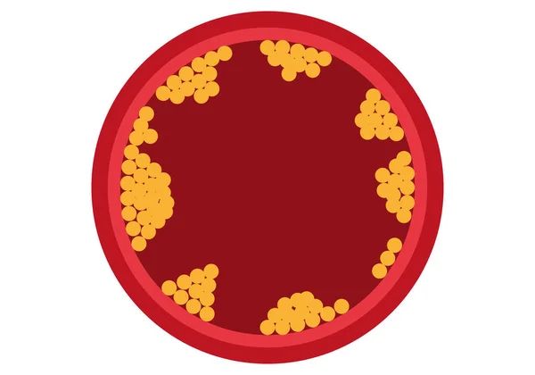 Kolesterol Ven Skuren Vit Bakgrund — Stock vektor