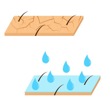 Cilt nemlendirme kesit görünümü.