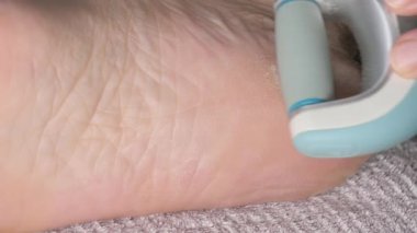 Ayak bileğindeki sert deriyi ovalamak.