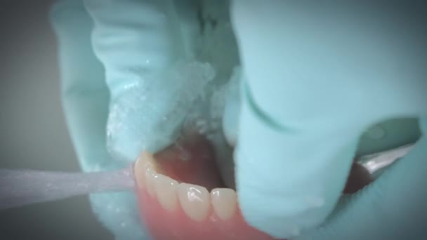 Closeup shot of dentures being washed under running water. — Stock Video