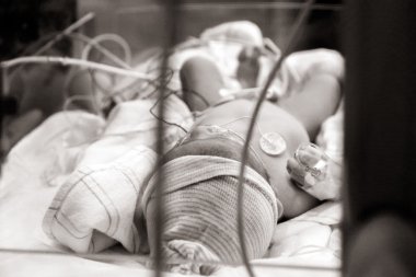 Yenidoğan NICU camı