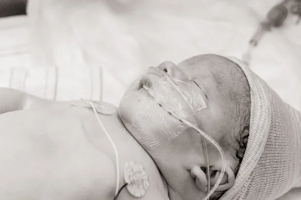 Baby With Medical Tubes — Stock Photo, Image