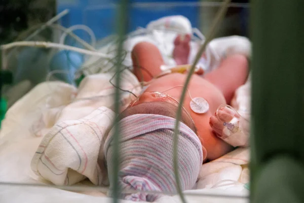 Newborn Through NICU Glass — Stock Photo, Image