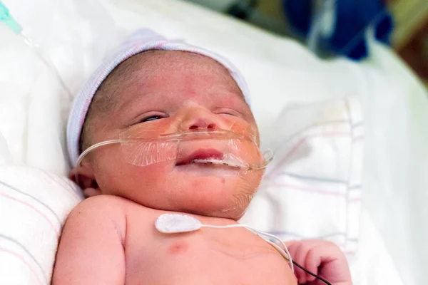 Bebê recém-nascido na UTIN — Fotografia de Stock