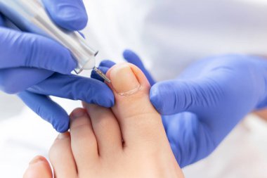 Özel elektrikli aletle ayak soyma. Elektrikli makine kullanan profesyonel donanım pedikürü. Tıbbi pedikür yapan hasta, podiyatriste gidiyor. SPA Salonu 'nda ayak tedavisi..