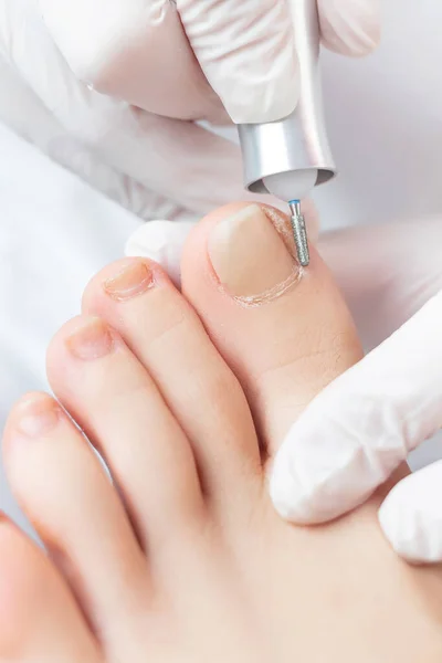 Peeling pieds avec dispositif électrique spécial.Professional pédicure matériel à l'aide d'une machine électrique.Patient sur la procédure de pédicure médicale, podiatre visiteur.Traitement des pieds dans le salon.Podiatry SPA clinique. — Photo