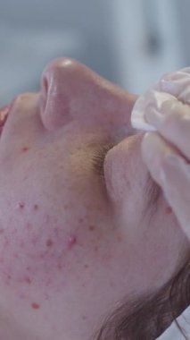 Kozmetik uzmanının randevusunda derisi sorunlu bir kadın yüzünü pamukla siliyor. Orta çekim