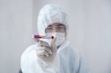 Tıbbi PPE 'deki adam araştırmacısı laboratuvarda pozitif kan testi tüpü olduğunu gösteriyor.