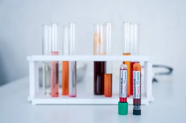 Amostra Tubos Teste Sangue Para Diagnóstico Coronavírus Infecção Covid Laboratório — Fotografia de Stock