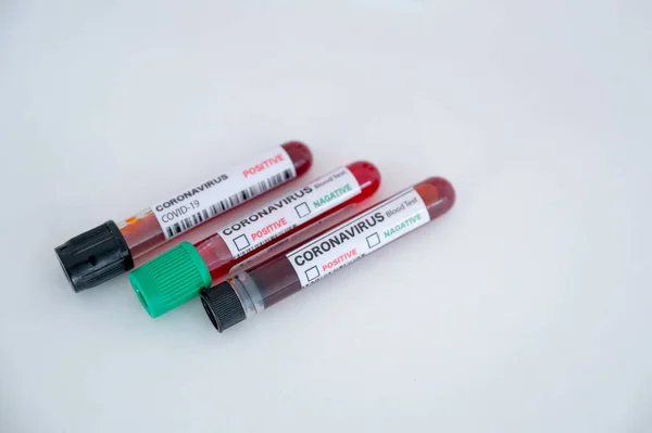 Muestra Tubos Análisis Sangre Para Diagnóstico Coronavirus Infección Por Covid —  Fotos de Stock