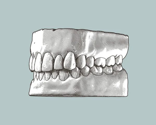 モノクローム ヴィンテージ エングレービング ドローイング歯とガム クローズドアゴ パースペクティブ サイド ビューは 灰色の背景に隔離された歯の閉塞イラスト — ストックベクタ