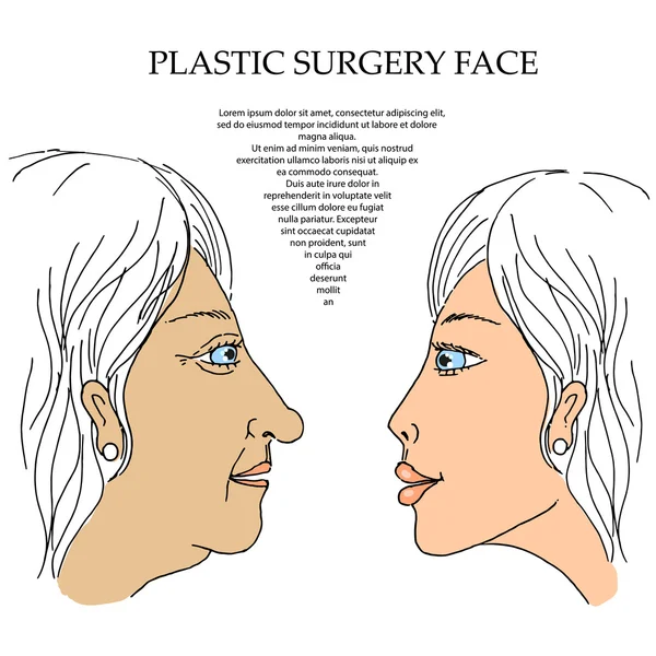 Cirugía plástica cara 5 — Vector de stock