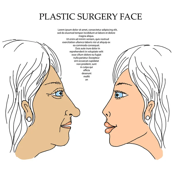 Cirurgia plástica rosto 5 —  Vetores de Stock