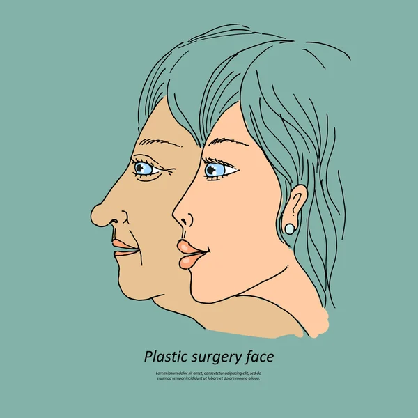 Chirurgie plastique face2 — Image vectorielle