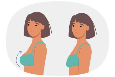 Kadın göğüsleri için estetik ameliyat yaptırmış. Boyutunu arttırmak ya da dayanıklılığını arttırmak için implant taktırmış. Göğüs ameliyatından önce ve sonra iki kızın karşılaştırılması ve sarkık meme uçlarının kaldırılması.