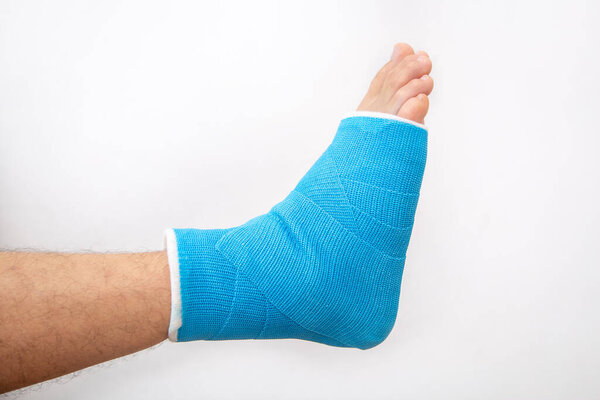 Blue splint ankle. Bandaged leg cast on male patient on white background isolated. Sports injury concept.