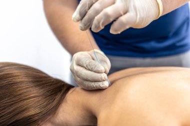 Yakından bakınca eldivenli bir terapistin hastaların sırtına ince bir iğne batırdığını görüyoruz. Sıcak cilt tonları ve temiz bir arka plan desteği sağlığın iyileşmesi kişisel bakım ve ağrı kesici kavramları.