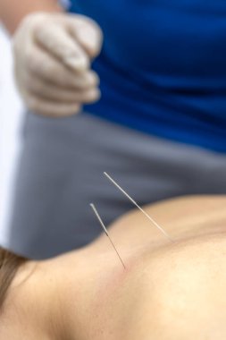 Muayene sırasında eldivenli bir doktor omuz ve köprücük kemiği bölgesini incelerken kadın hasta hislerine odaklanıyor. Nötr klinik içi ağrı kesici ve iyileşme konusunda tıbbi içeriğe uygun.