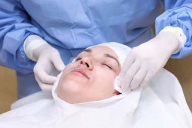 Yüz cerrahisi kaldırma prosedürü.