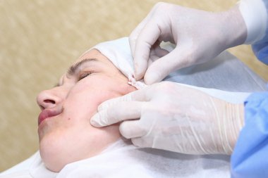 Yüz cerrahisi kaldırma prosedürü.