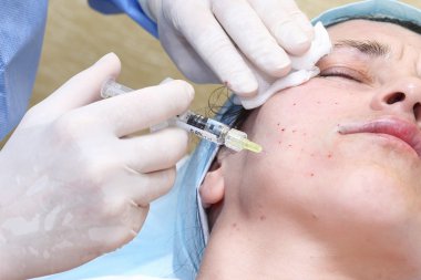 BIO-canlandırılması kopyalama wrink hyaluronik asit tedavisi ile