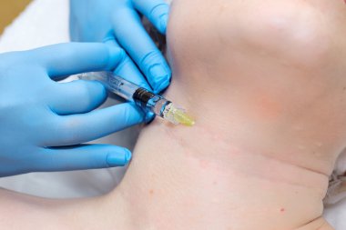 Anti-yaş enjeksiyon tedavisi. Kırışıklık Azaltma.