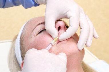 Dolgu ile dudak enjeksiyon prosedürü.