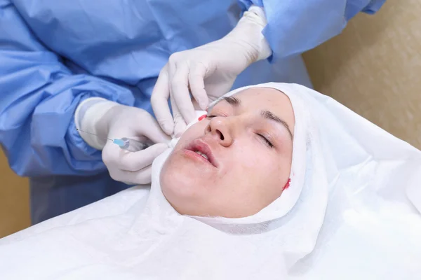 Procedimiento de cirugía de lifting facial . — Foto de Stock