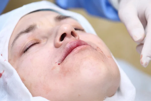 Postup zrušení operace obličeje. — Stock fotografie
