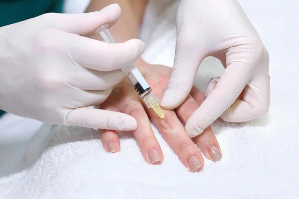 Anti-Age-Injektionstherapie. Handverjüngung. — Stockfoto