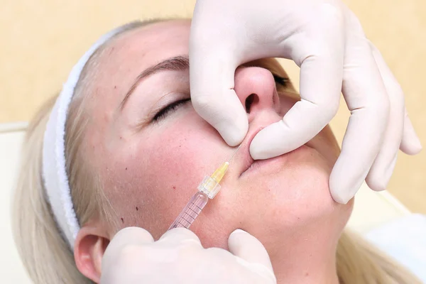 Procedure of lip injection with filler. — Stock Photo, Image