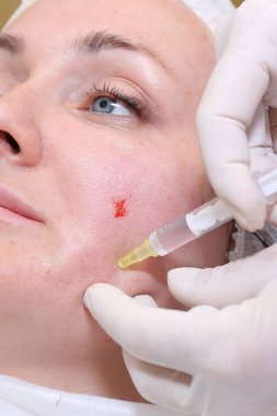 Anti-yaş enjeksiyon tedavisi. Kırışıklık Azaltma taklit.