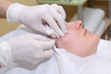 Yüz cerrahisi kaldırma prosedürü.