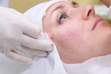 Yüz cerrahisi kaldırma prosedürü.