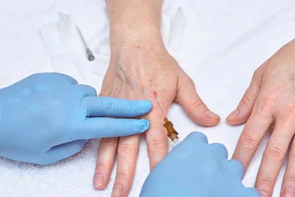 Anti-age injection therapy. Hand rejuvenation.
