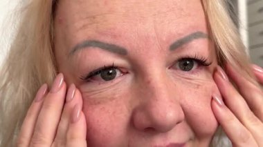 Doğal kaşları ve kirpikleri olan bir kadın. Kabarık göz kapaklarına krem sürüyor. Yüz estetiği, göz kapağı kaldırma, blefaroplasti, kozmetik, göz altı torbalarını cerrahi müdahaleyle çıkarmak.