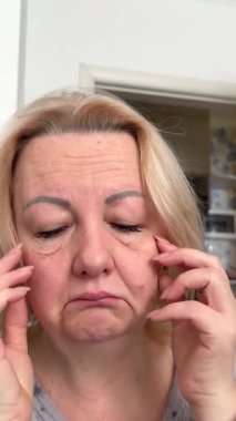 Boynunda kırışıklıklar, boynu şişmiş, tiroidi olan orta yaşlı bir kadın. - Evet. Yüksek kalite 4k görüntü